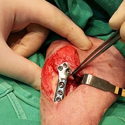 cirurgia-thumb-003.jpg